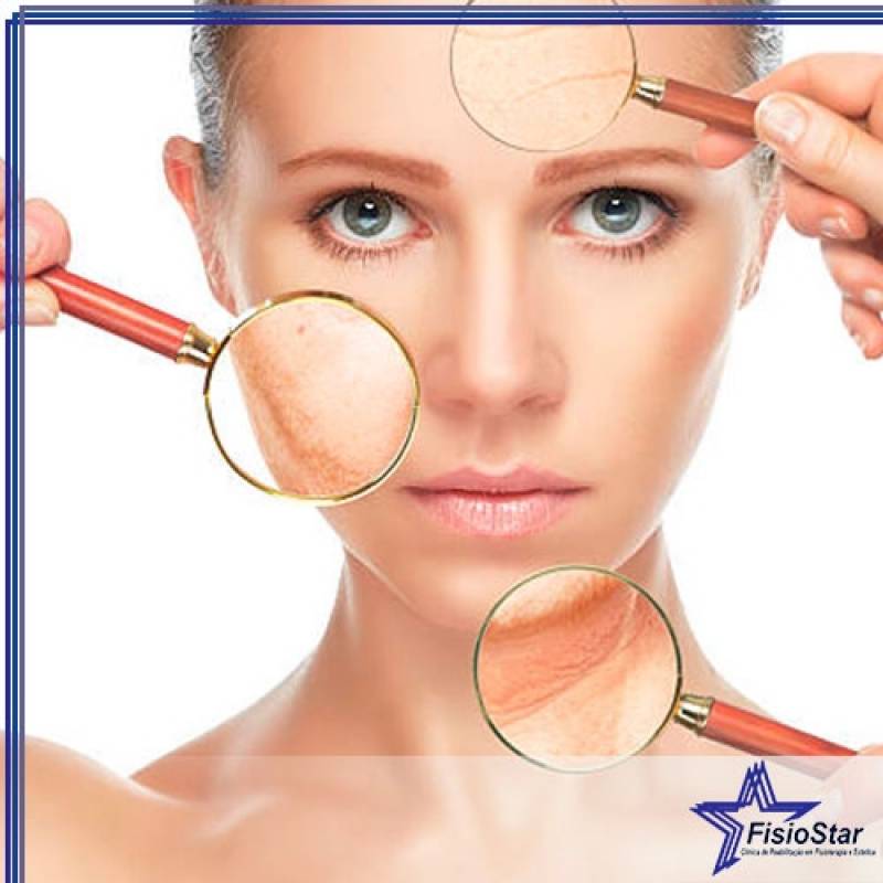 Clínica para Estética Rosto Manchas Zona Sul - Tratamento de Peeling Facial