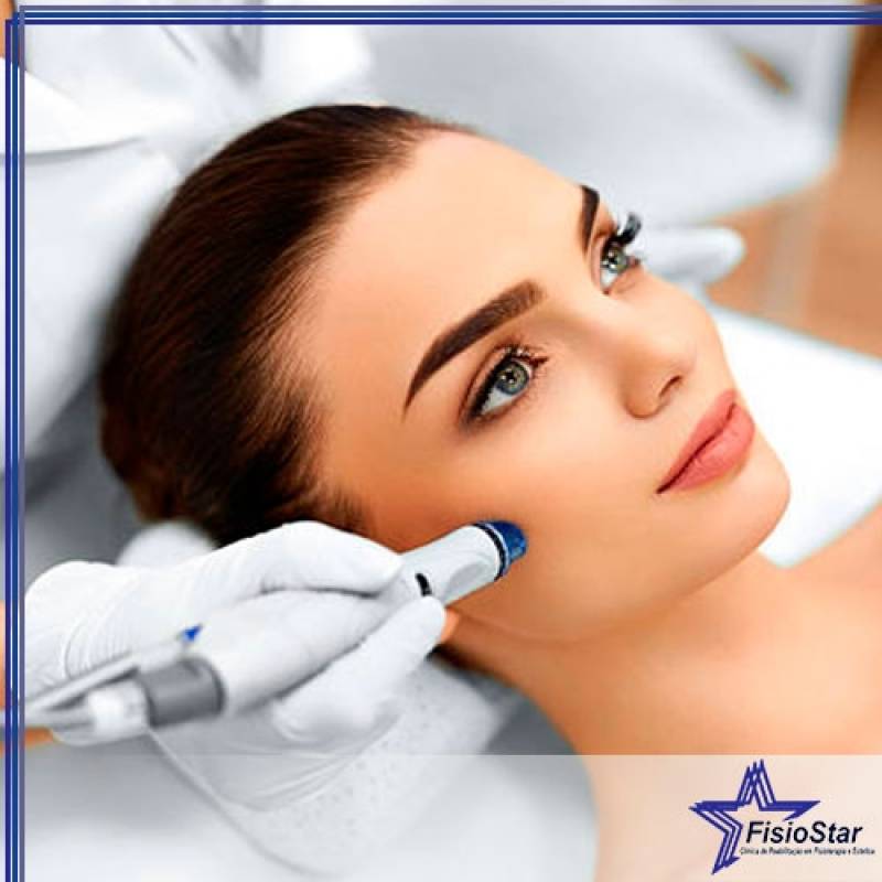 Peeling Facial para Manchas Campo Grande - Tratamento de Peeling Facial