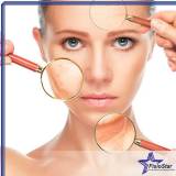 clínica para peeling facial para acne Pompéia