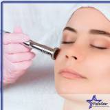 limpeza de pele facial para acne valor Nova Piraju