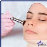 onde encontro tratamento facial para acne Pinheiros