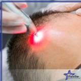 tratamento capilar a laser valor Raposo Tavares