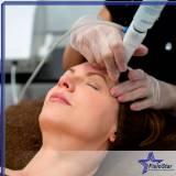 tratamento de peeling facial Perus