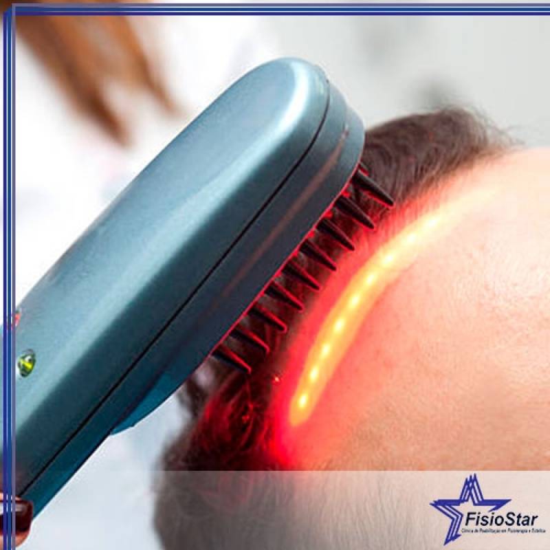 Tratamento Capilar a Laser Vila Suzana - Tratamento Capilar Profissional