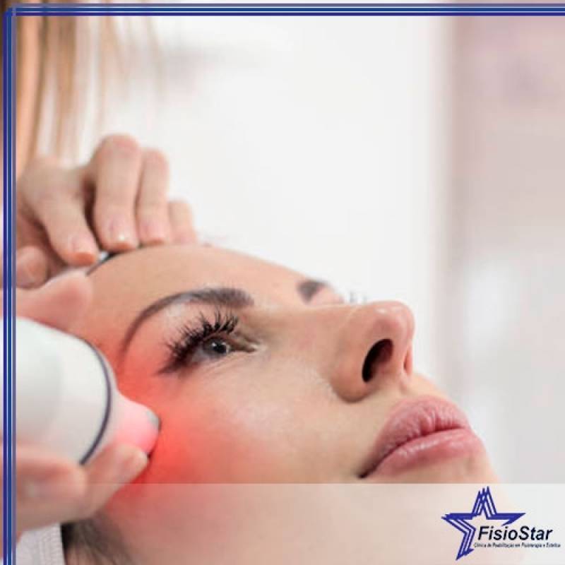 Tratamento Estética para o Rosto Valor Conjunto Residencial Butantã - Peeling Facial para Acne