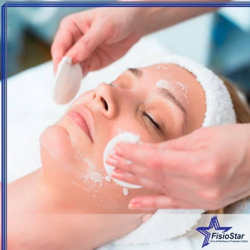 Tratamento Facial para Acne Preço Sumaré - Estética Rosto Manchas