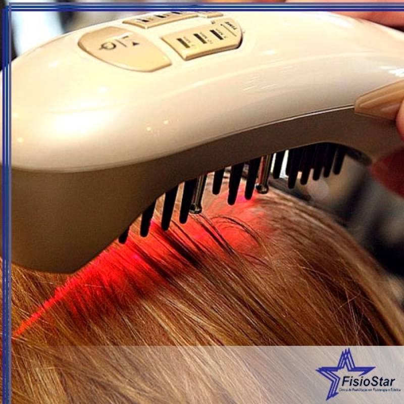 Tratamento para Crescer Cabelo Preço Taboão da Serra - Tratamento Capilar para Queda